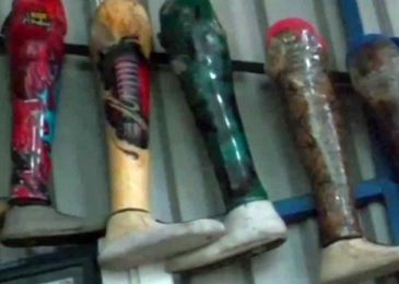 Kaki Palsu Ini Jelek, Namun Dicari Karena Ringan, Dinamis, Terjangkau